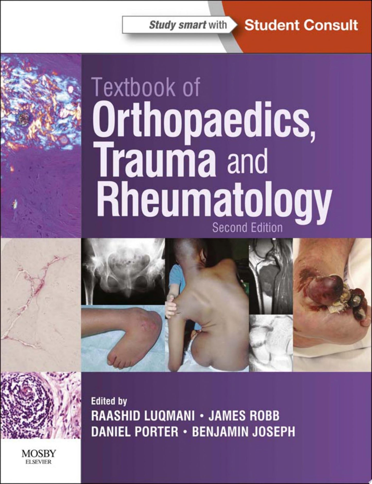 Textbook of Orthopaedics, Trauma and Rheumatology, 2nd Edition