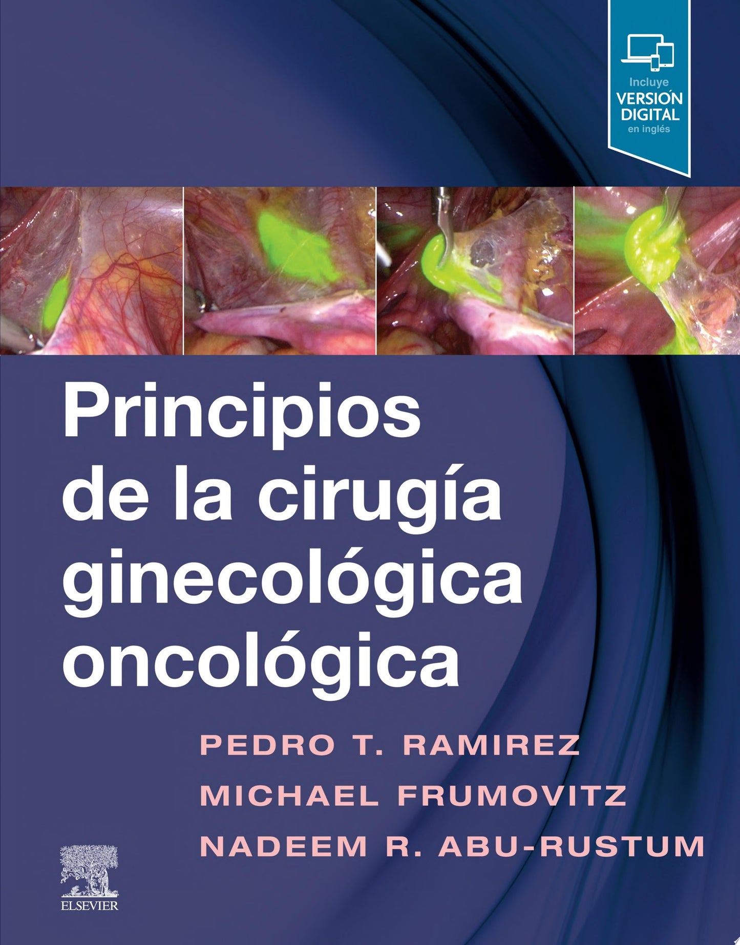 Principios de la cirugía ginecológica oncológica, 1e