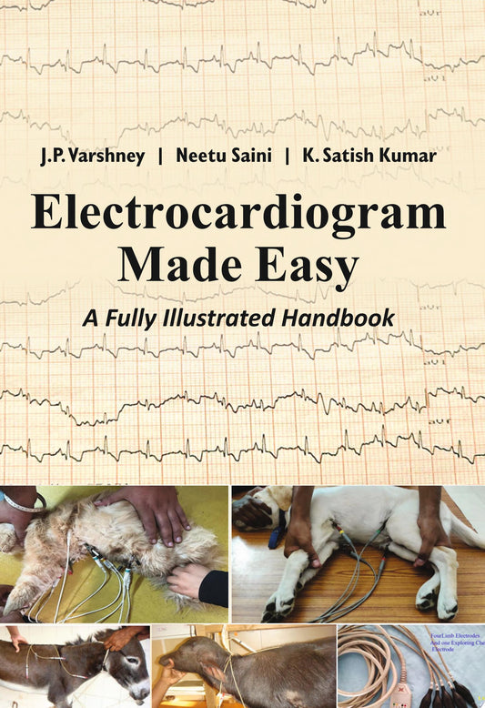 Electrocardiogram Made Easy: A Fully Illustrated Handbook