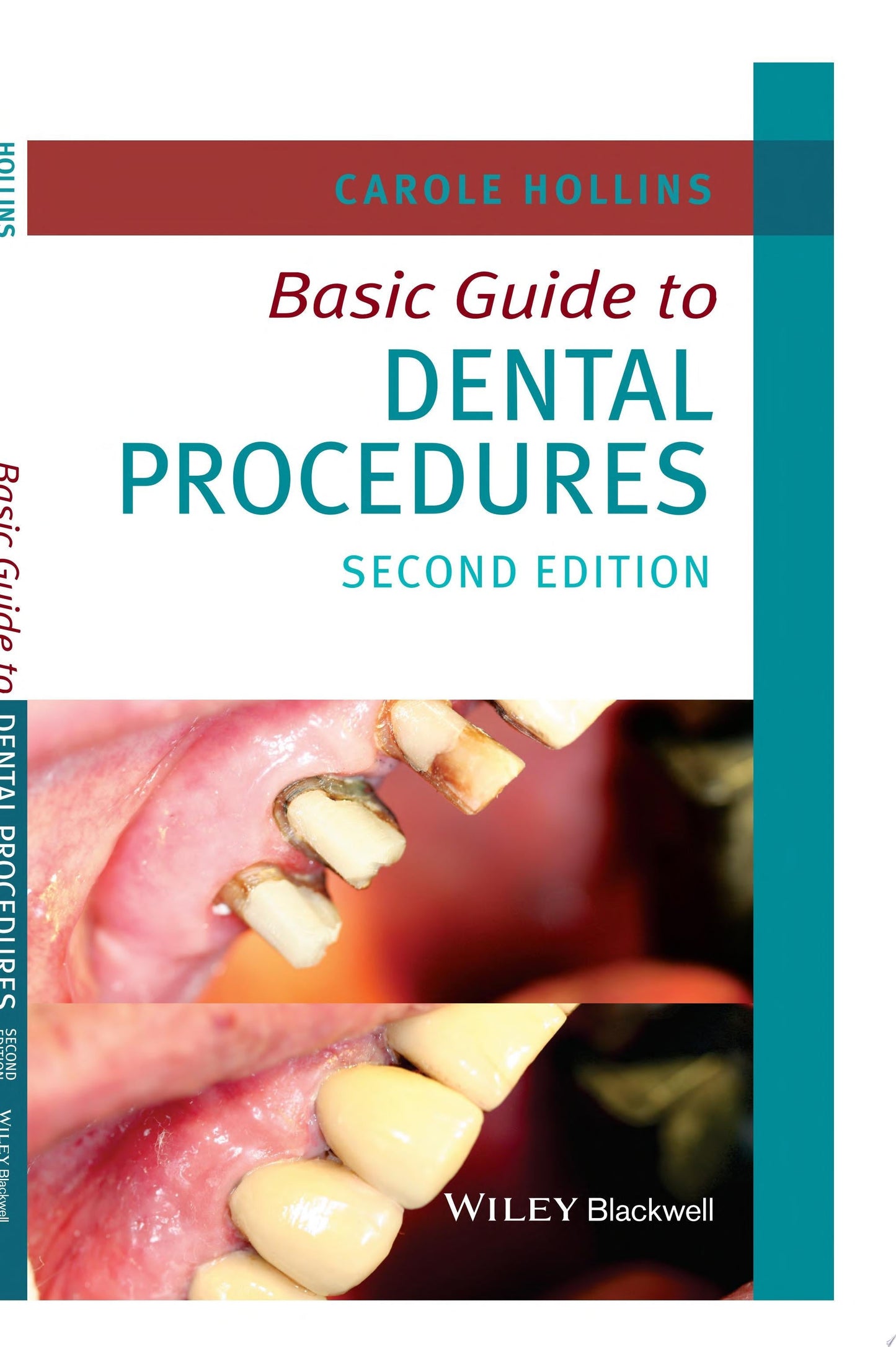 Basic Guide to Dental Procedures