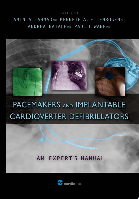 Pacemakers and Implantable Cardioverter Defibrillators: An Expert’s Manual