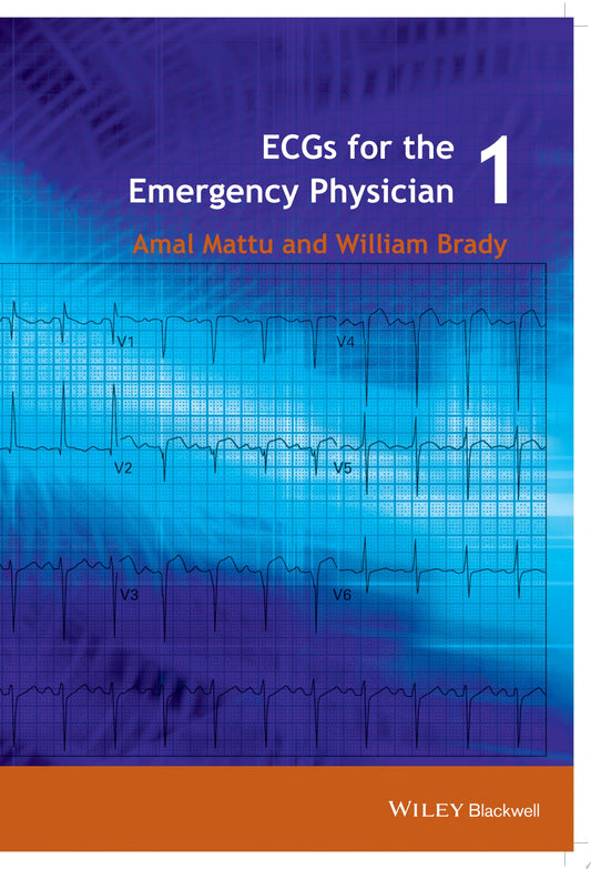 ECG’s for the Emergency Physician 1
