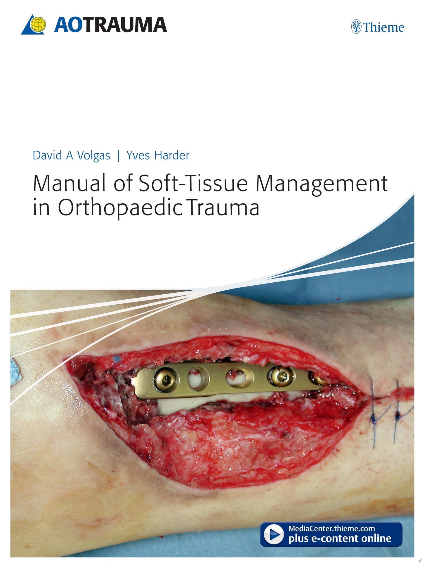 Manual of Soft-tissue Management in Orthopaedic Trauma (ORIGINAL PDF from publisher)