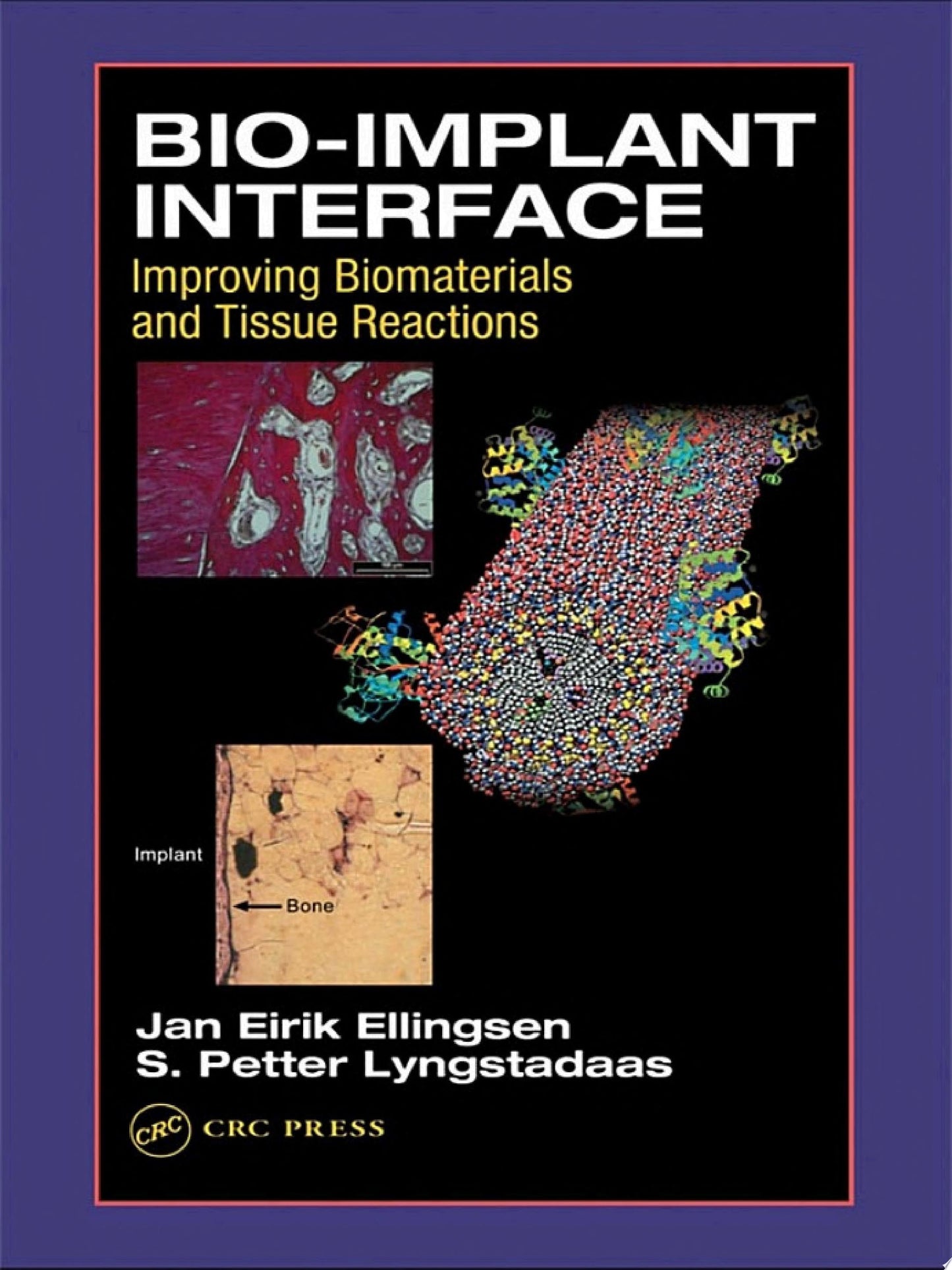 Bio-Implant Interface