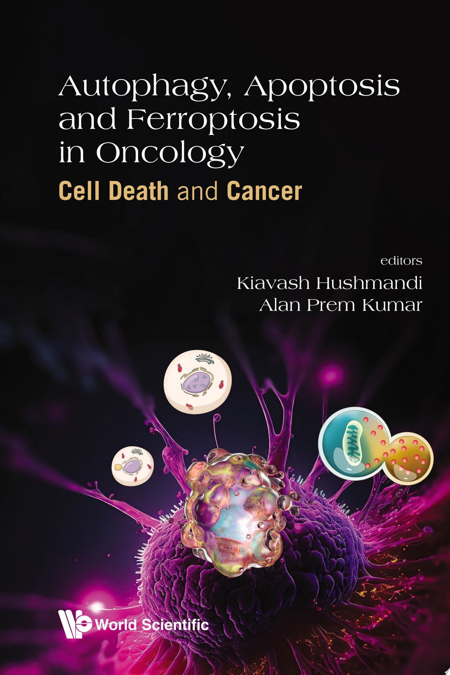 Autophagy, Apoptosis and Ferroptosis in Oncology: Cell Death and Cancer