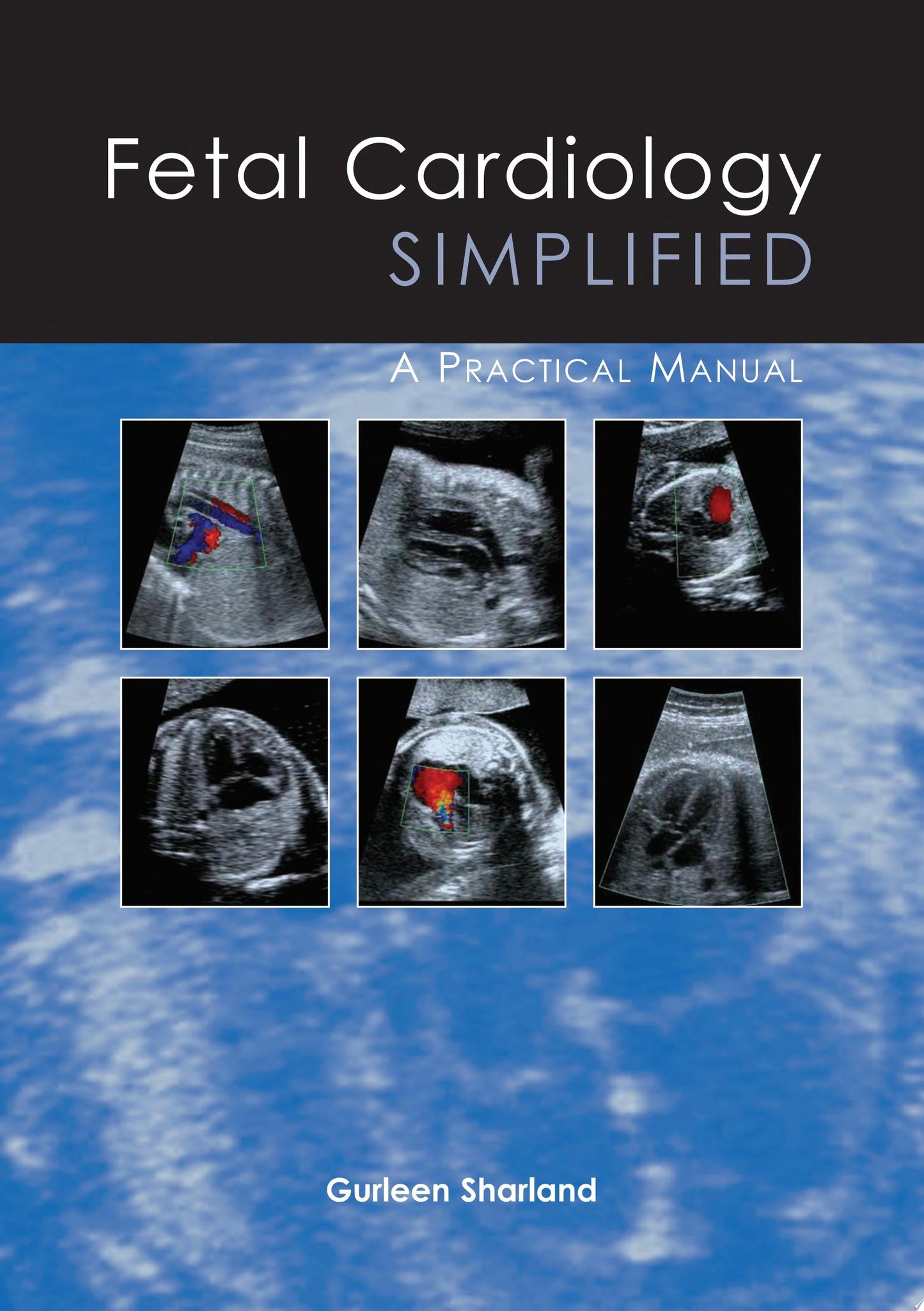 Fetal Cardiology Simplified: A Practical Manual