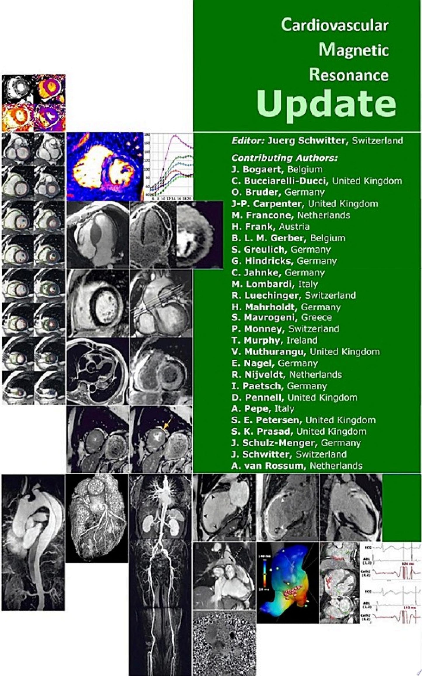 Cardiovascular Magnetic Resonance