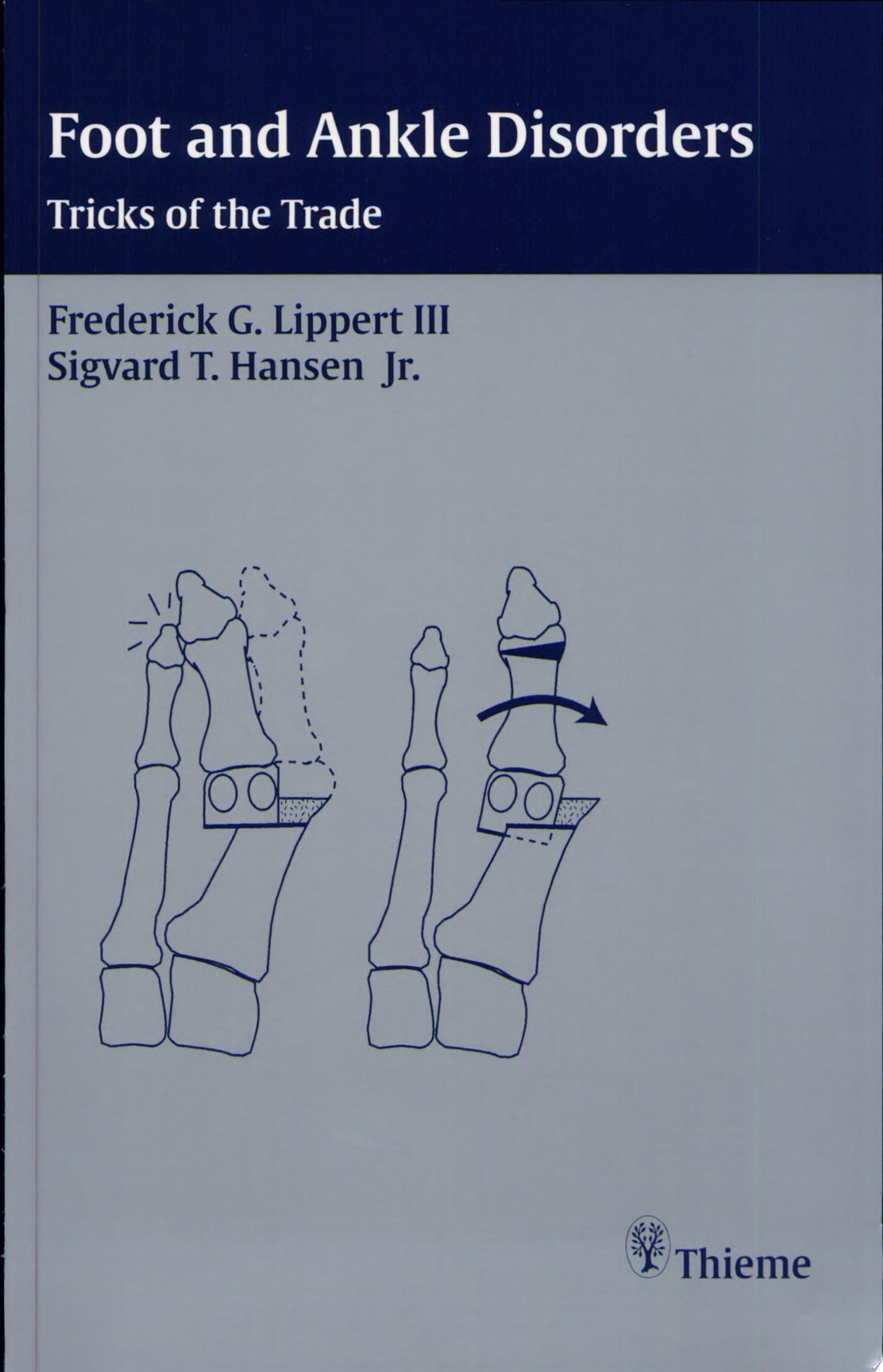 Foot and Ankle Disorders: Tricks of the Trade