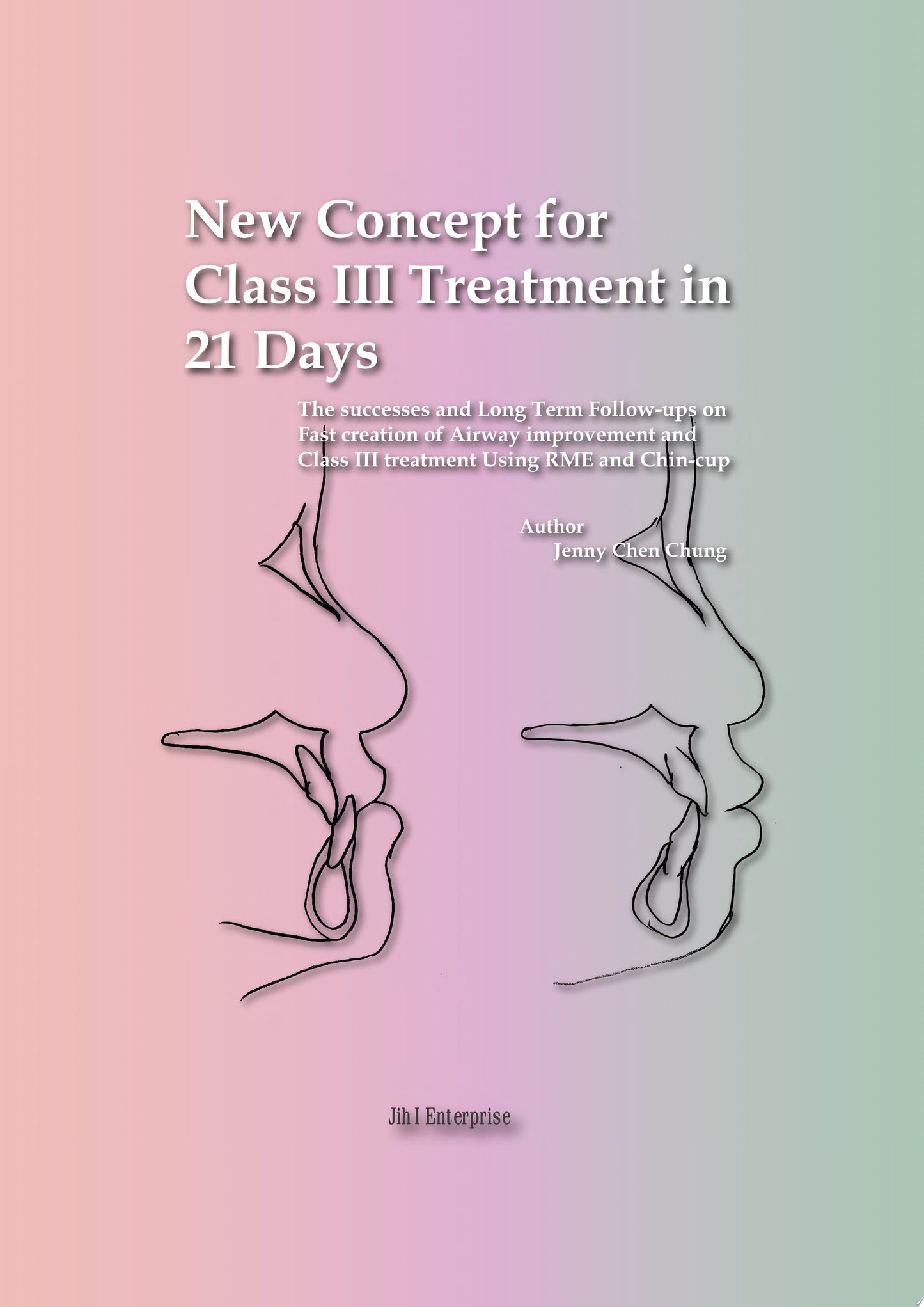 New concept for Class III treatment in 21 Days