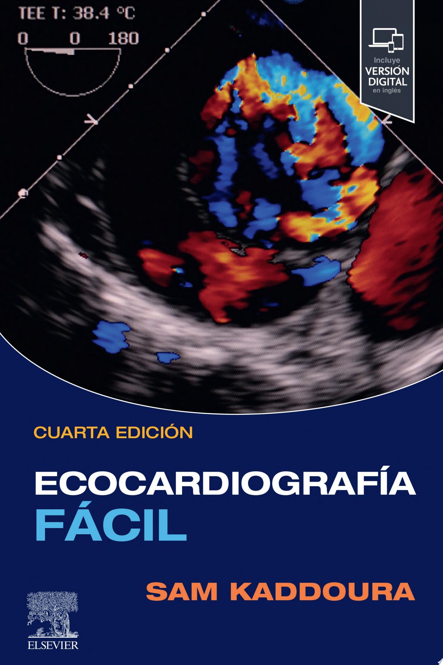 Ecocardiografía fácil, 3rd Edition
