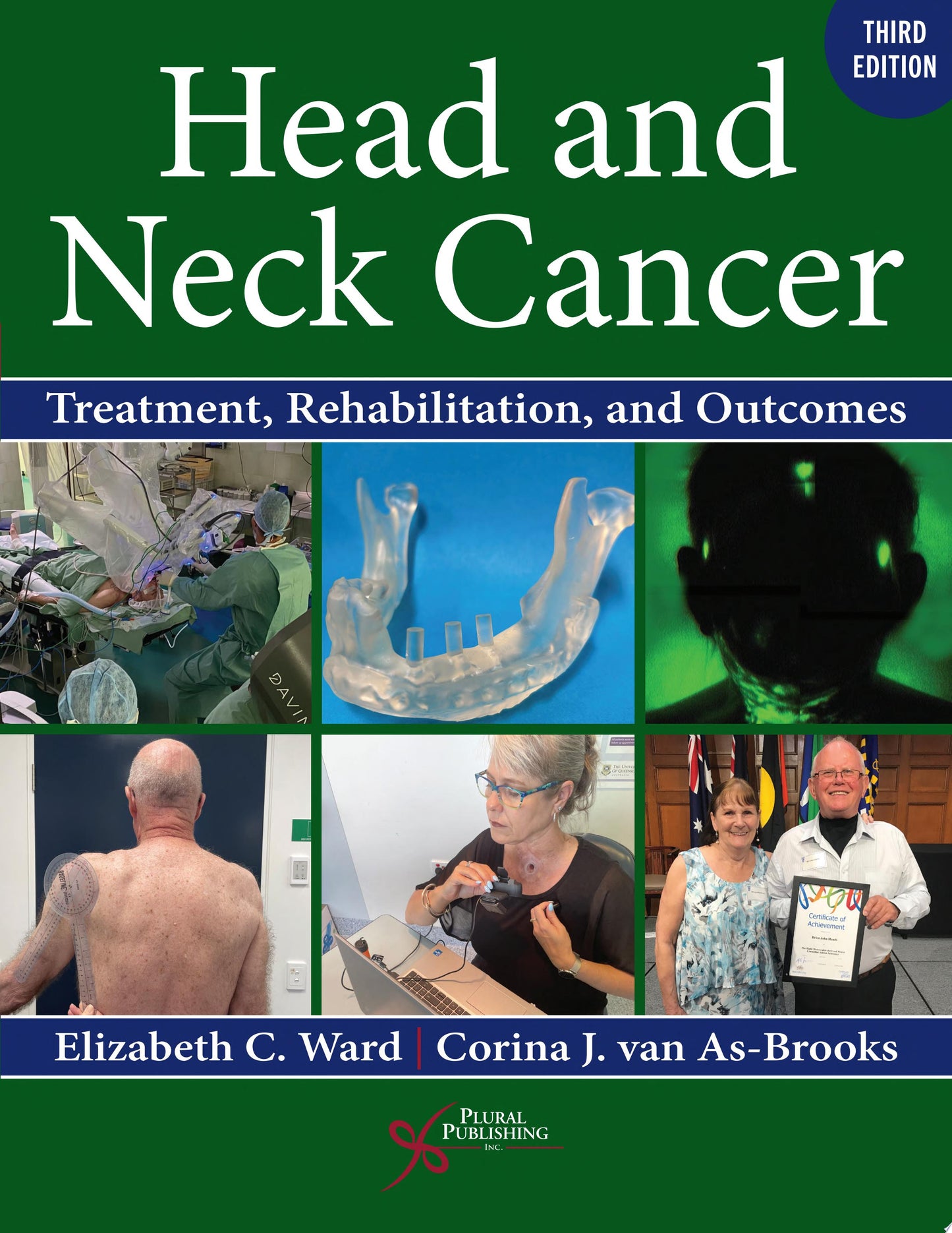 Head and Neck Cancer: Treatment, Rehabilitation, and Outcomes