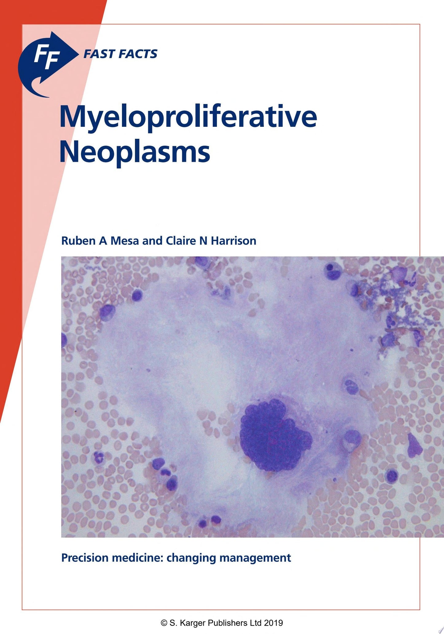 Fast Facts: Myeloproliferative Neoplasms