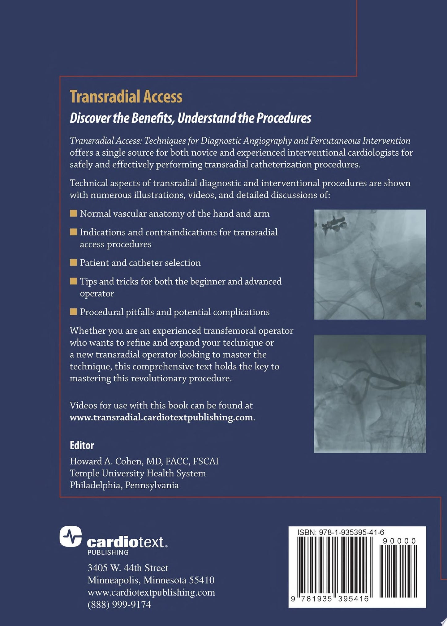 Transradial Access: Techniques for Diagnostic Angiography and Percutaneous Intervention