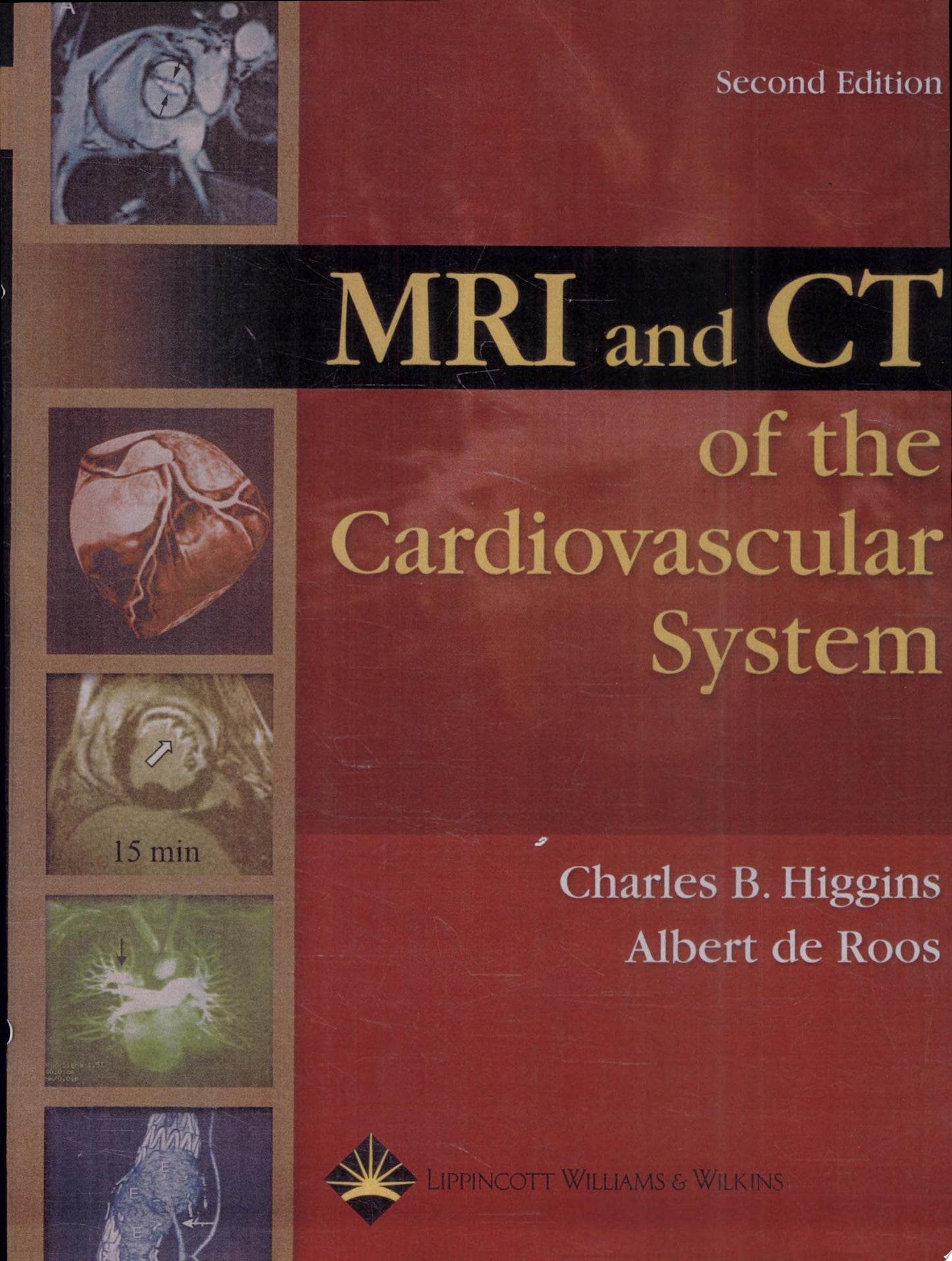 MRI & CT of the Cardiovascular System, 3rd Edition