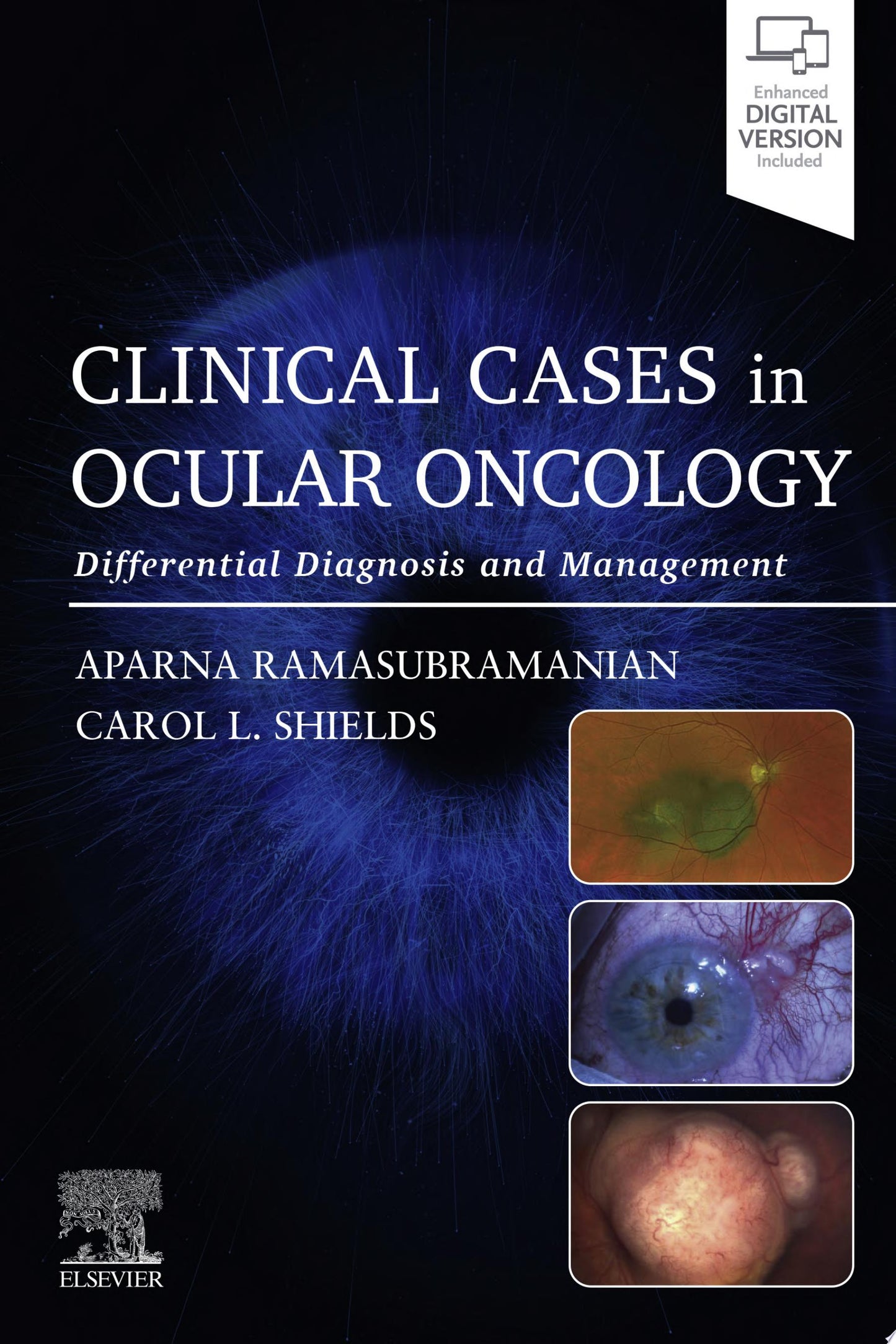 Clinical Cases in Ocular Oncology: Differential Diagnosis and Management