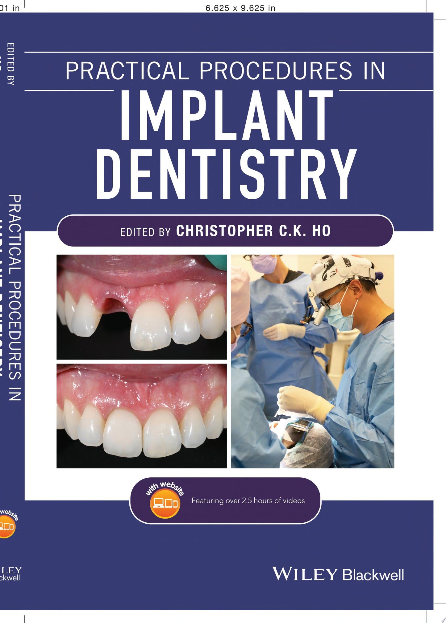 Practical Procedures in Implant Dentistry