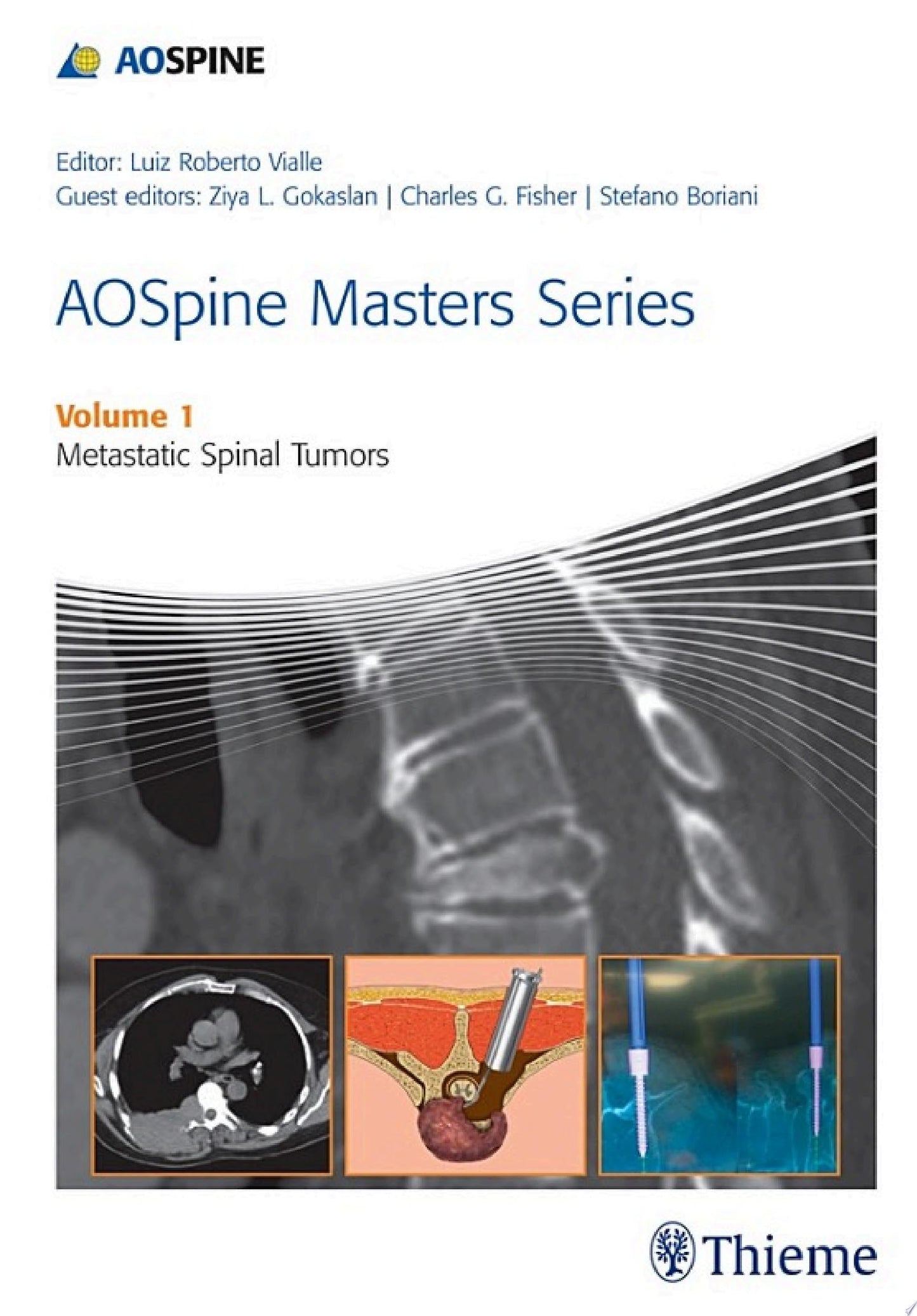 AOSpine Masters Series Volume 1: Metastatic Spinal Tumors (ORIGINAL PDF from Publisher)