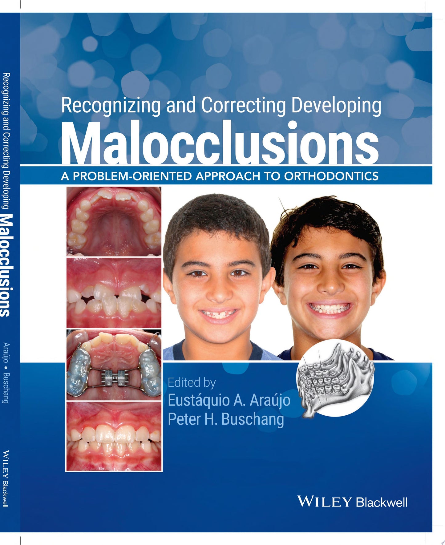 Recognizing and Correcting Developing Malocclusions