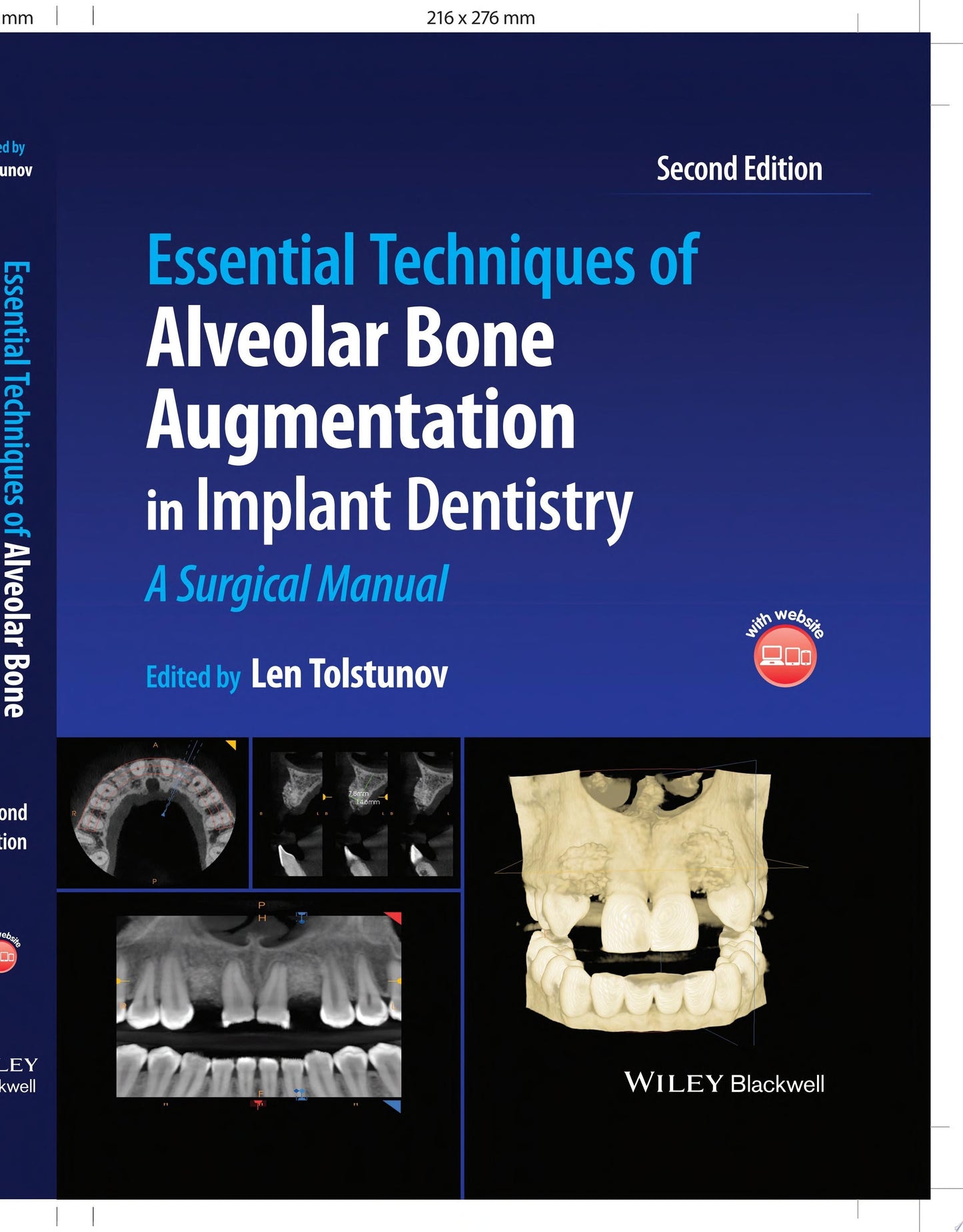 Essential Techniques of Alveolar Bone Augmentation in Implant Dentistry