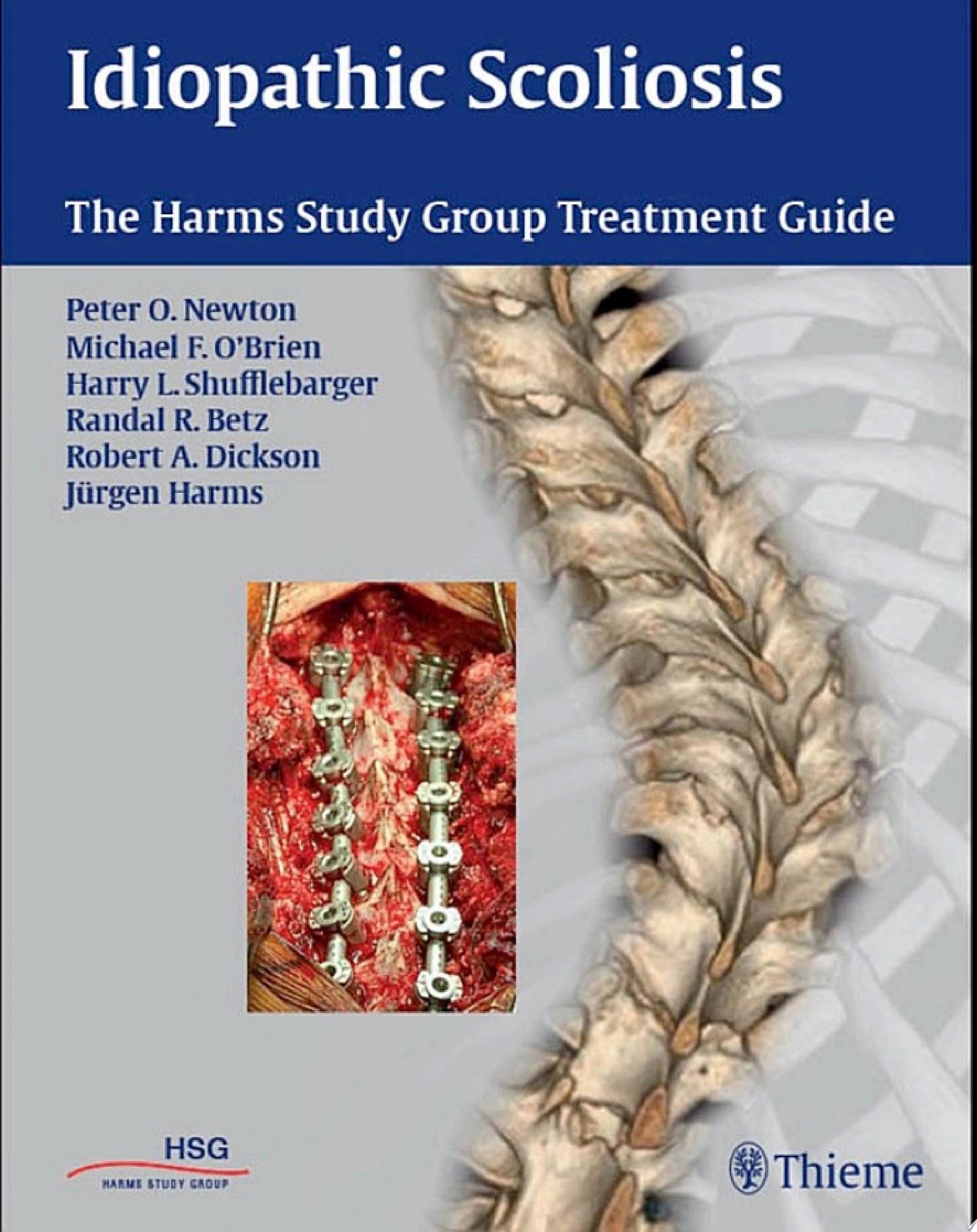 Idiopathic Scoliosis: The Harms Study Group Treatment Guide, 1st edition