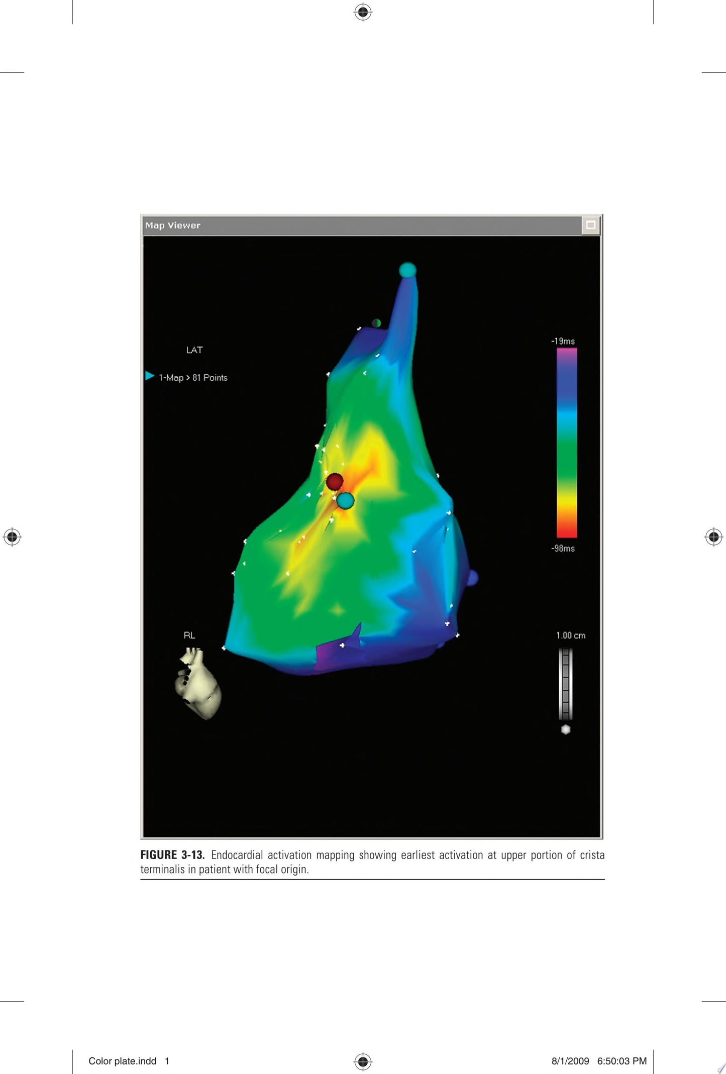 Electrophysiology: The Basics: A Companion Guide for the Cardiology Fellow during the EP Rotation