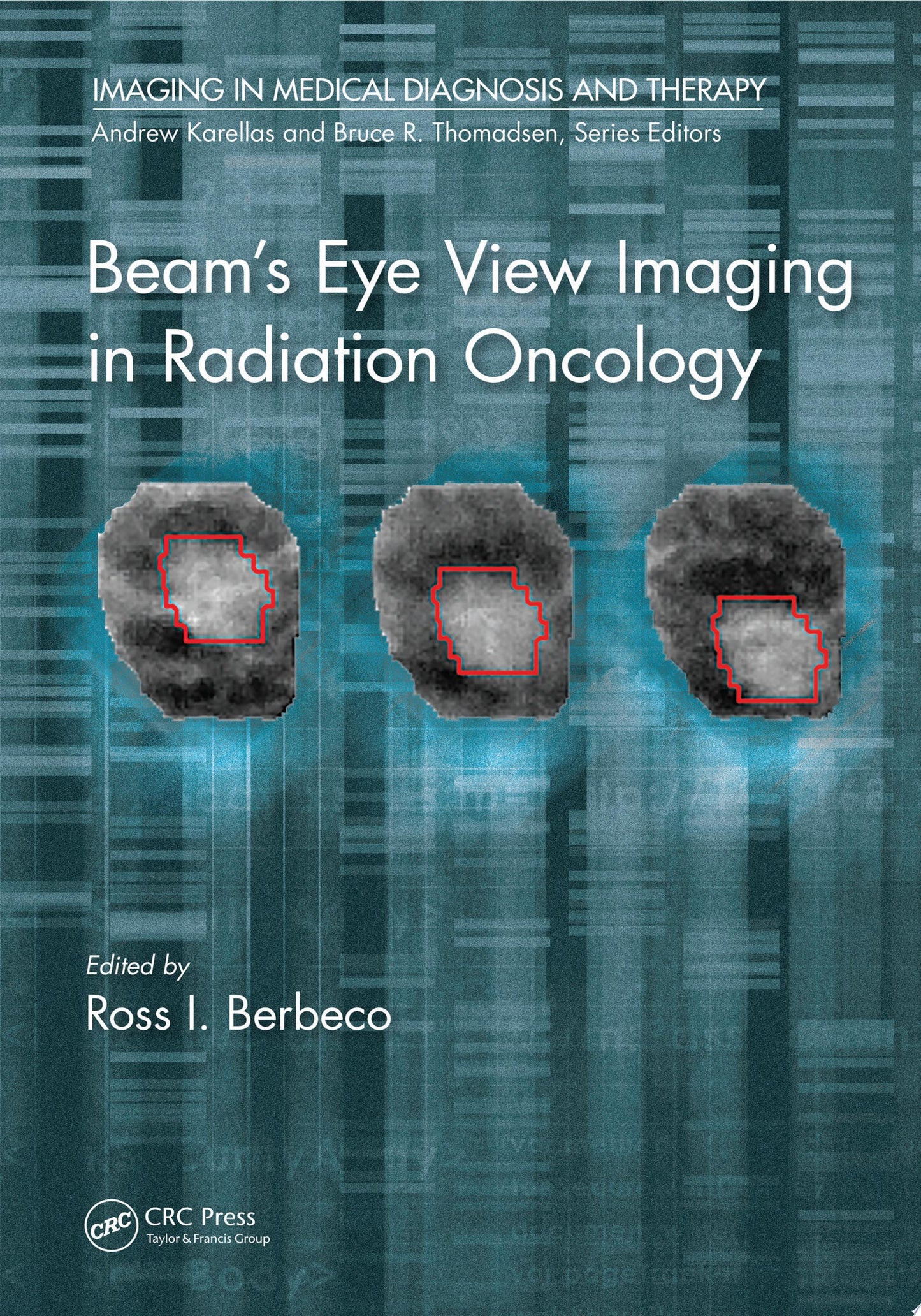 Beam’s Eye View Imaging in Radiation Oncology