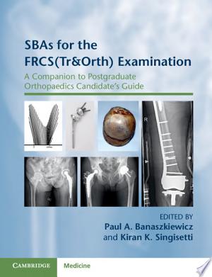 SBAs for the FRCS(Tr&Orth) Examination (A Companion to Postgraduate Orthopaedics Candidate’s Guide)