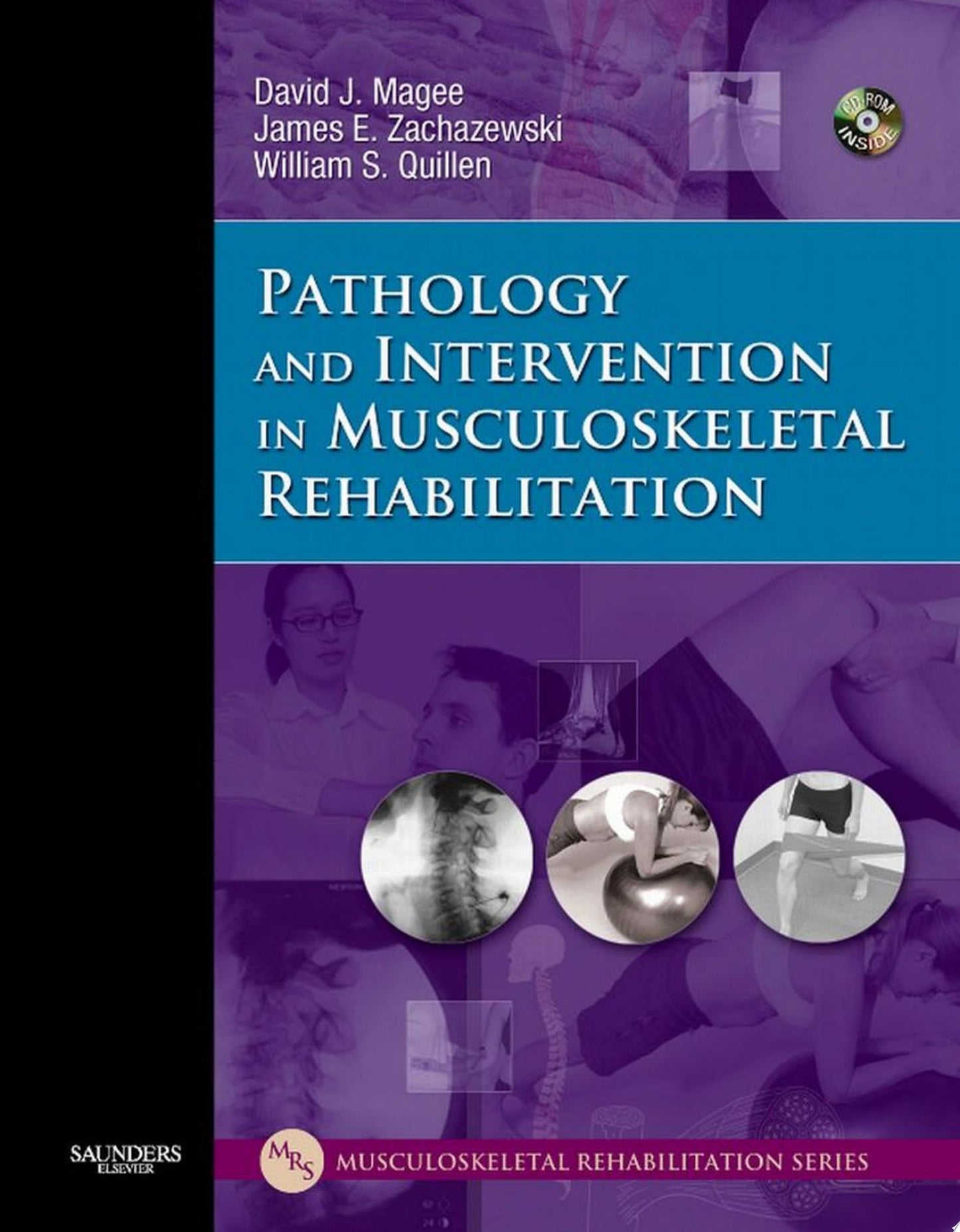 Pathology and Intervention in Musculoskeletal Rehabilitation, 2nd Edition