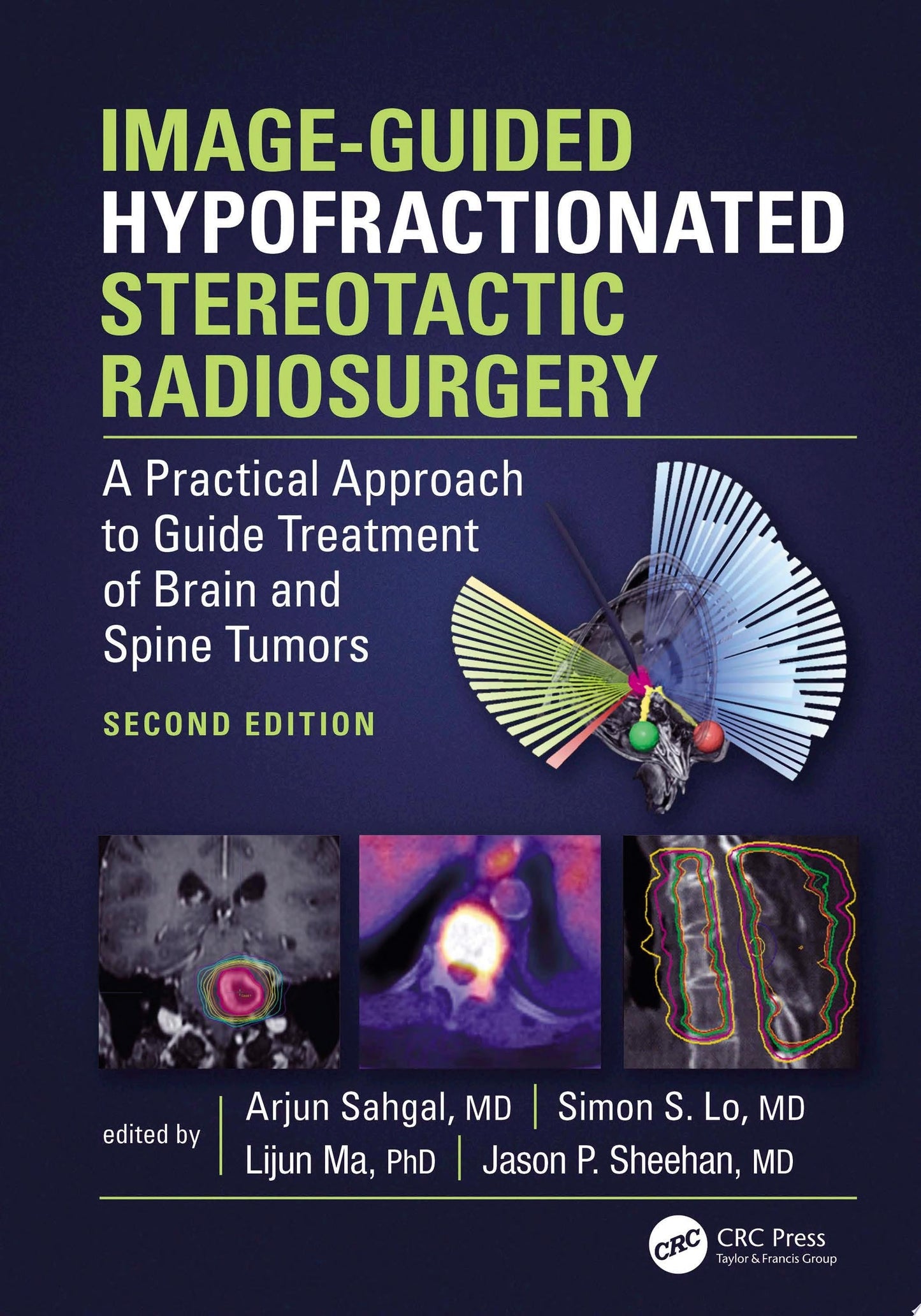 Spine Radiosurgery, 2nd Edition