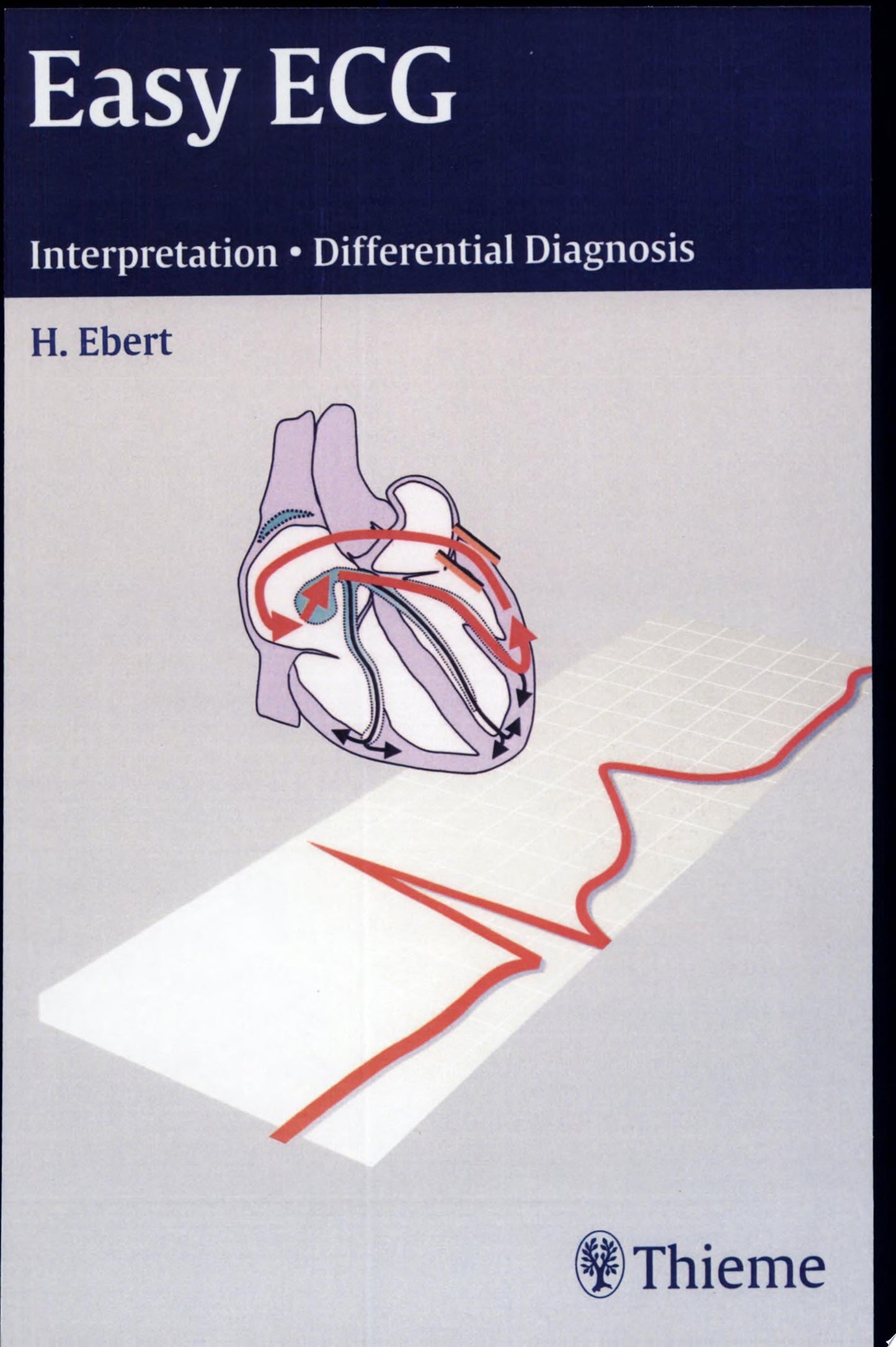 Easy ECG: Interpretation – Differential Diagnosis