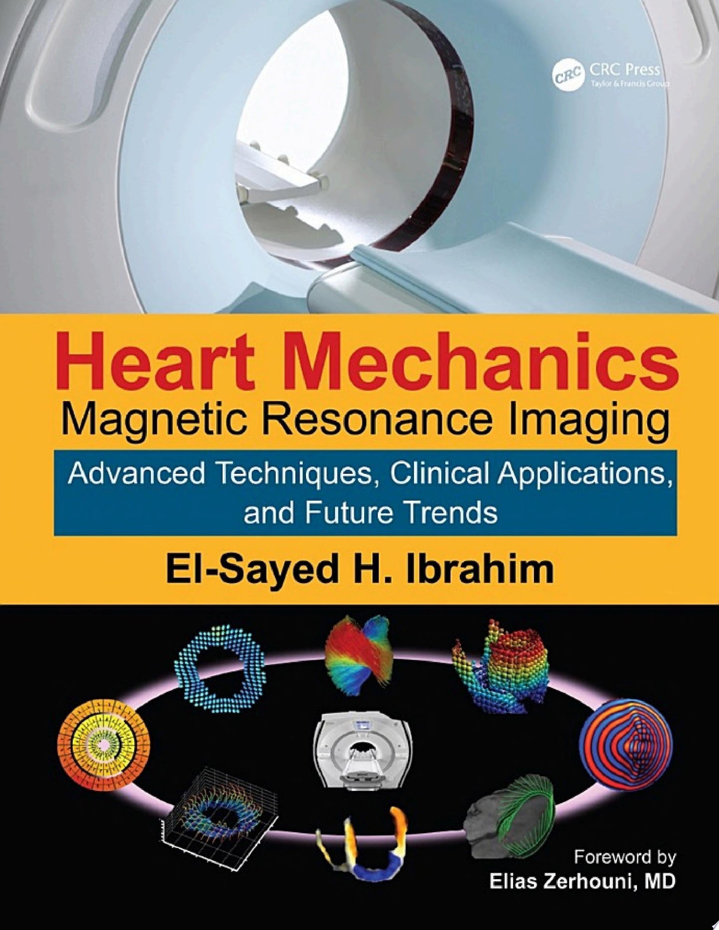 Heart Mechanics: Magnetic Resonance Imaging―Advanced Techniques, Clinical Applications, and Future Trends