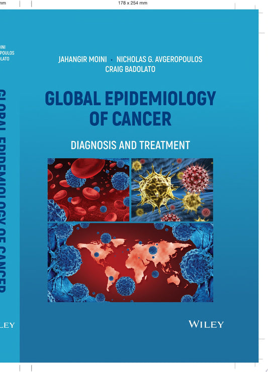 Global Epidemiology of Cancer: Diagnosis and Treatment