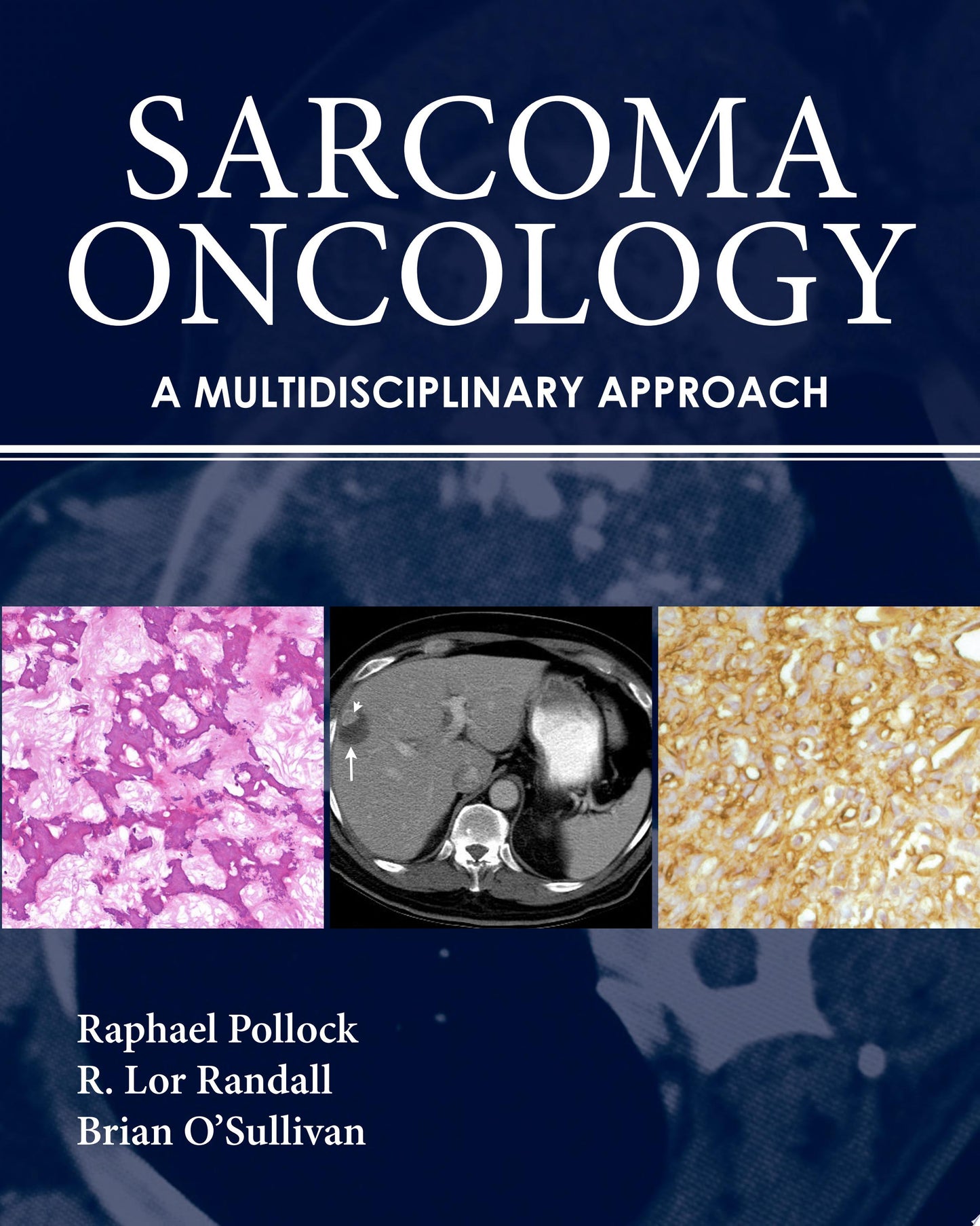 Sarcoma Oncology: A Multidisciplinary Approach