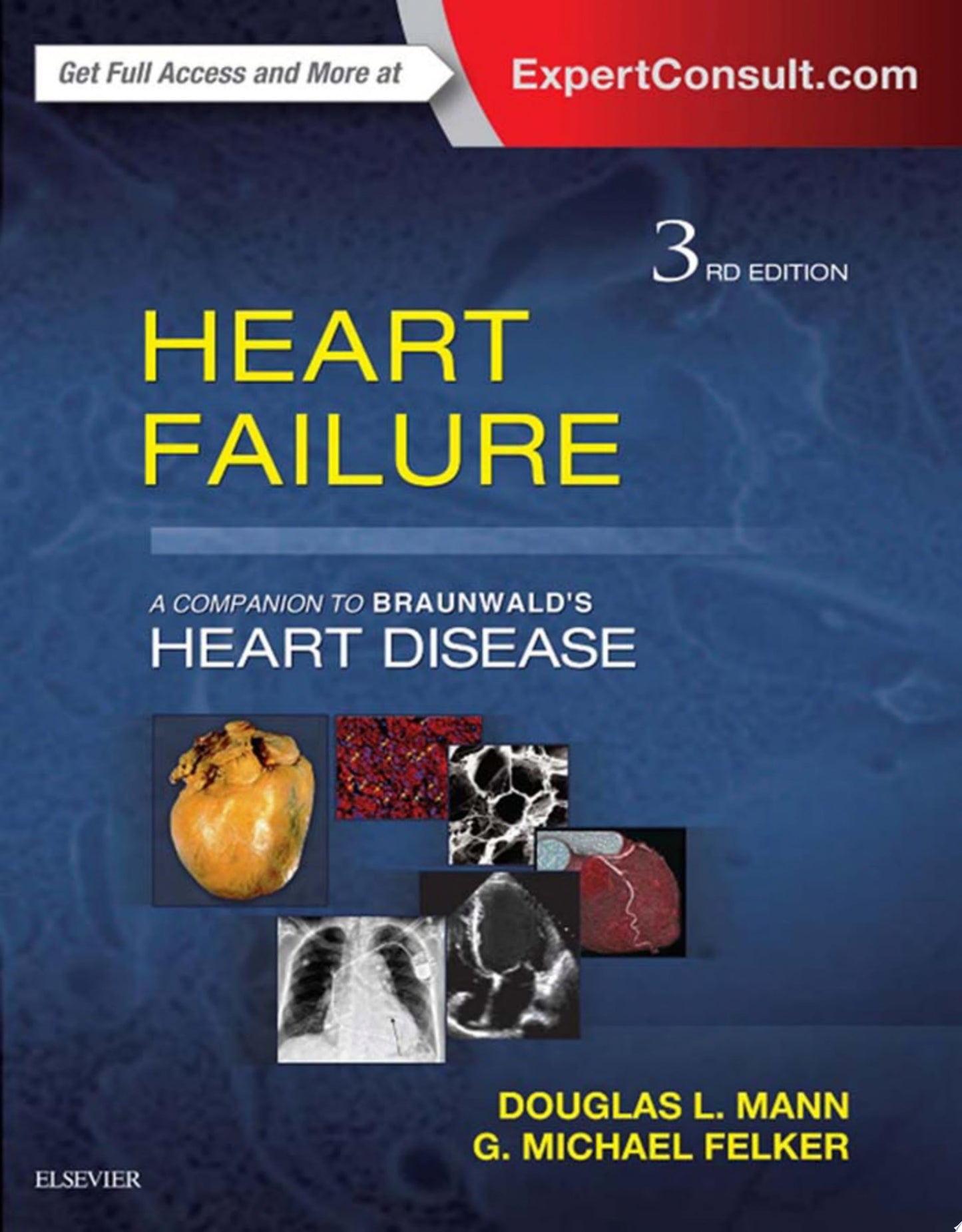 Heart Failure , 3rd Edition