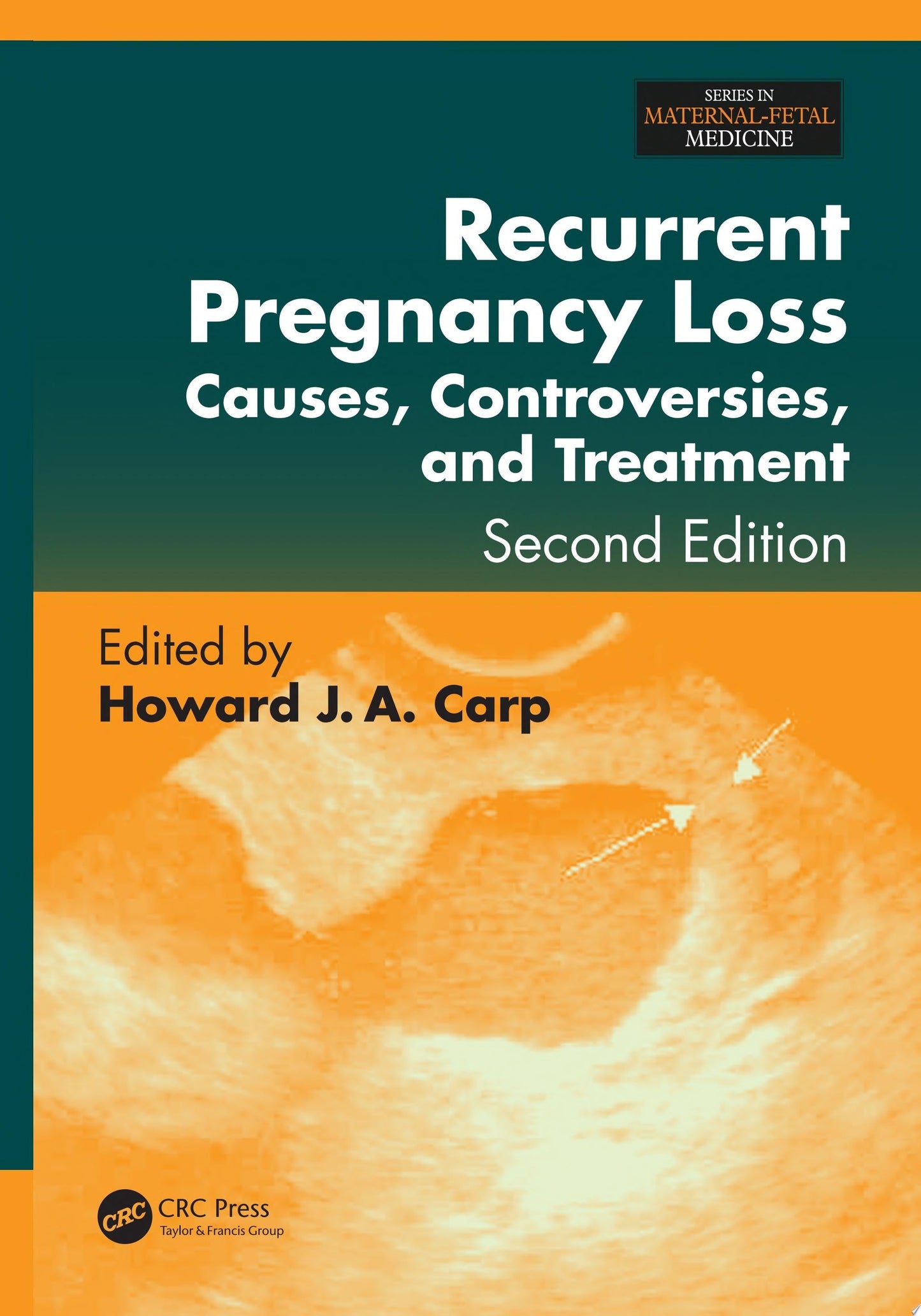 Recurrent Pregnancy Loss