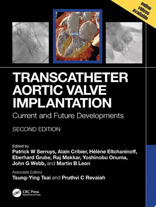 Transcatheter Aortic Valve Implantation: Current and Future Developments, 2nd edition