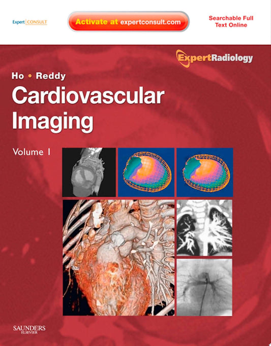 Cardiovascular Imaging, 2-Volume Set: Expert Radiology Series