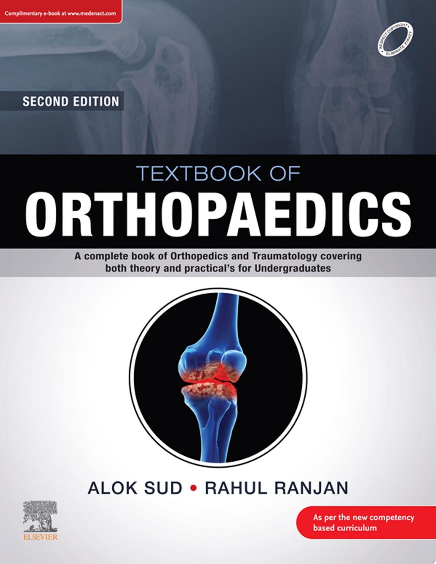 Shoulder Arthroplasty, 2e