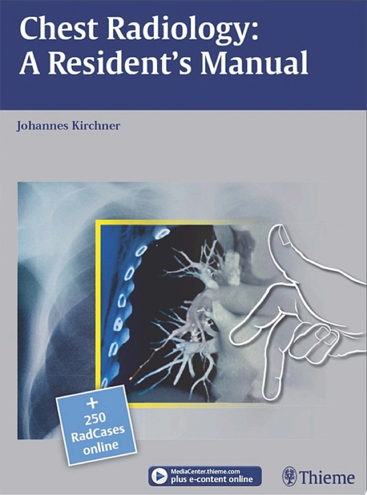 Chest Radiology– A Resident’s Manual