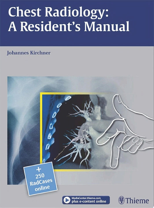 Chest Radiology– A Resident’s Manual