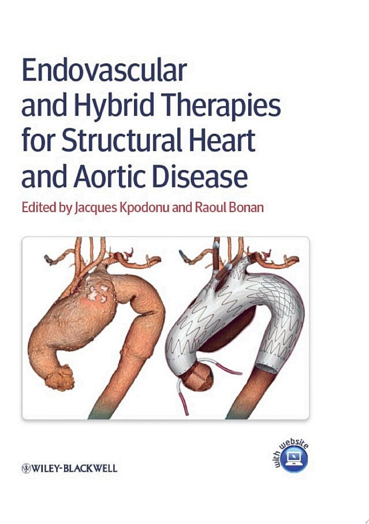 Endovascular and Hybrid Therapies for Structural Heart and Aortic Disease