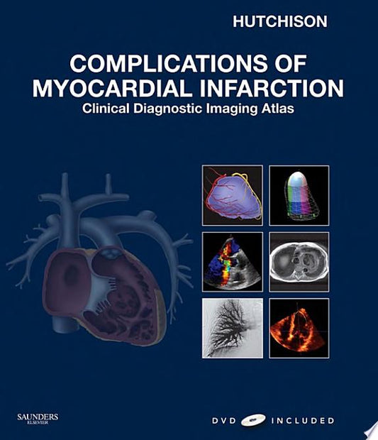 Complications of Myocardial Infarction: Clinical Diagnostic Imaging Atlas