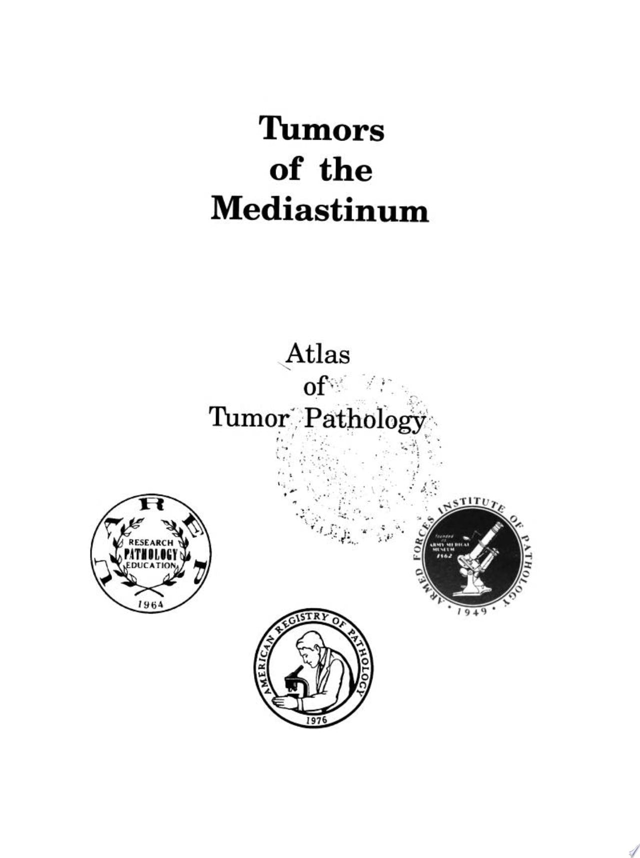 Tumors of the Mediastinum
