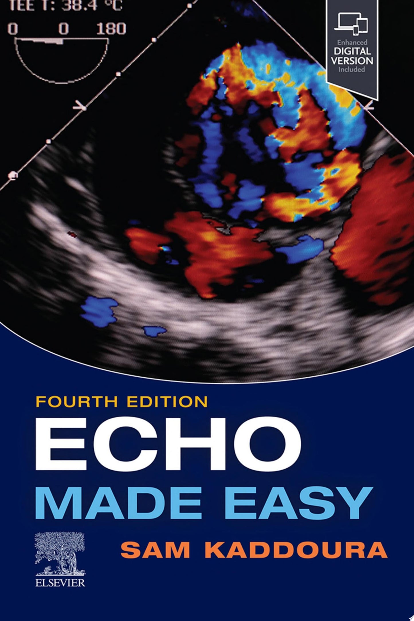 Echo Made Easy, 2nd Edition