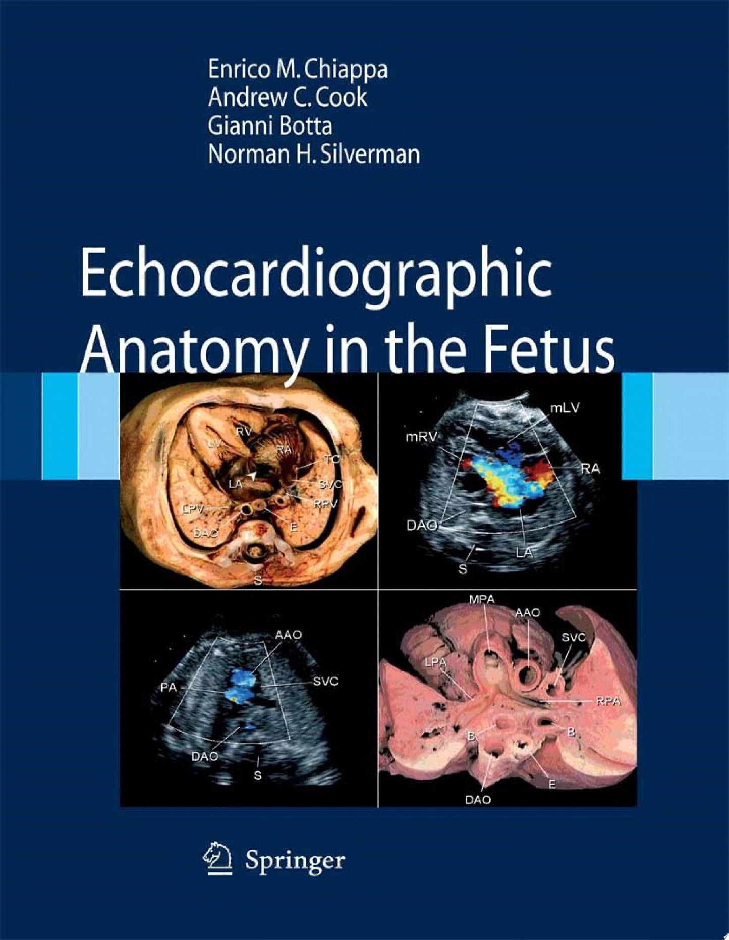 Echocardiographic Anatomy in the Fetus, 2008th Edition