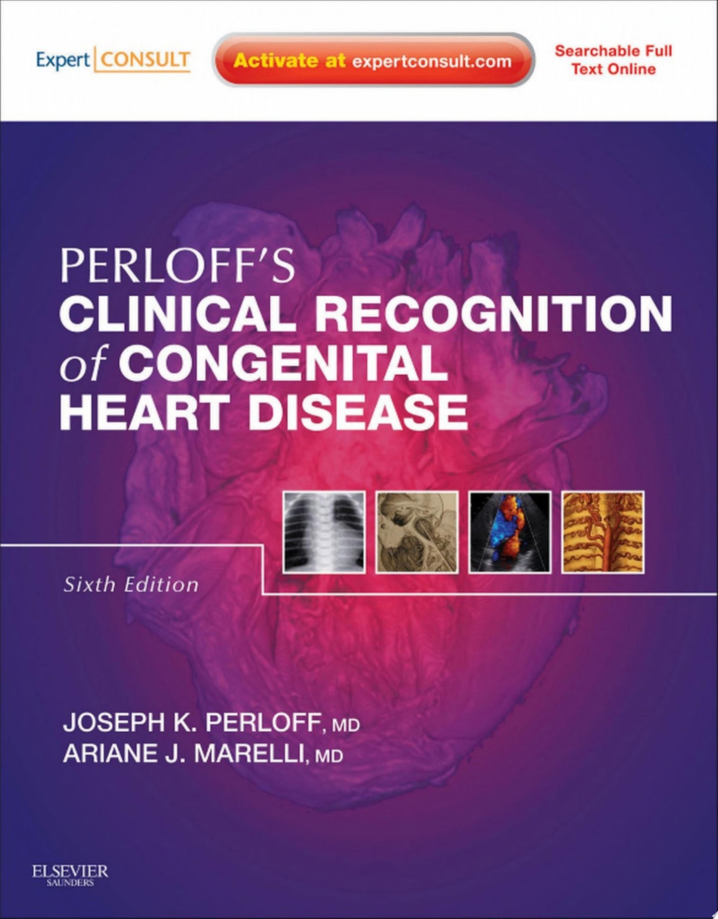 Congenital Heart Disease in Adults, 3rd Edition
