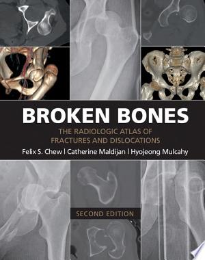 Broken Bones: The Radiologic Atlas of Fractures and Dislocations