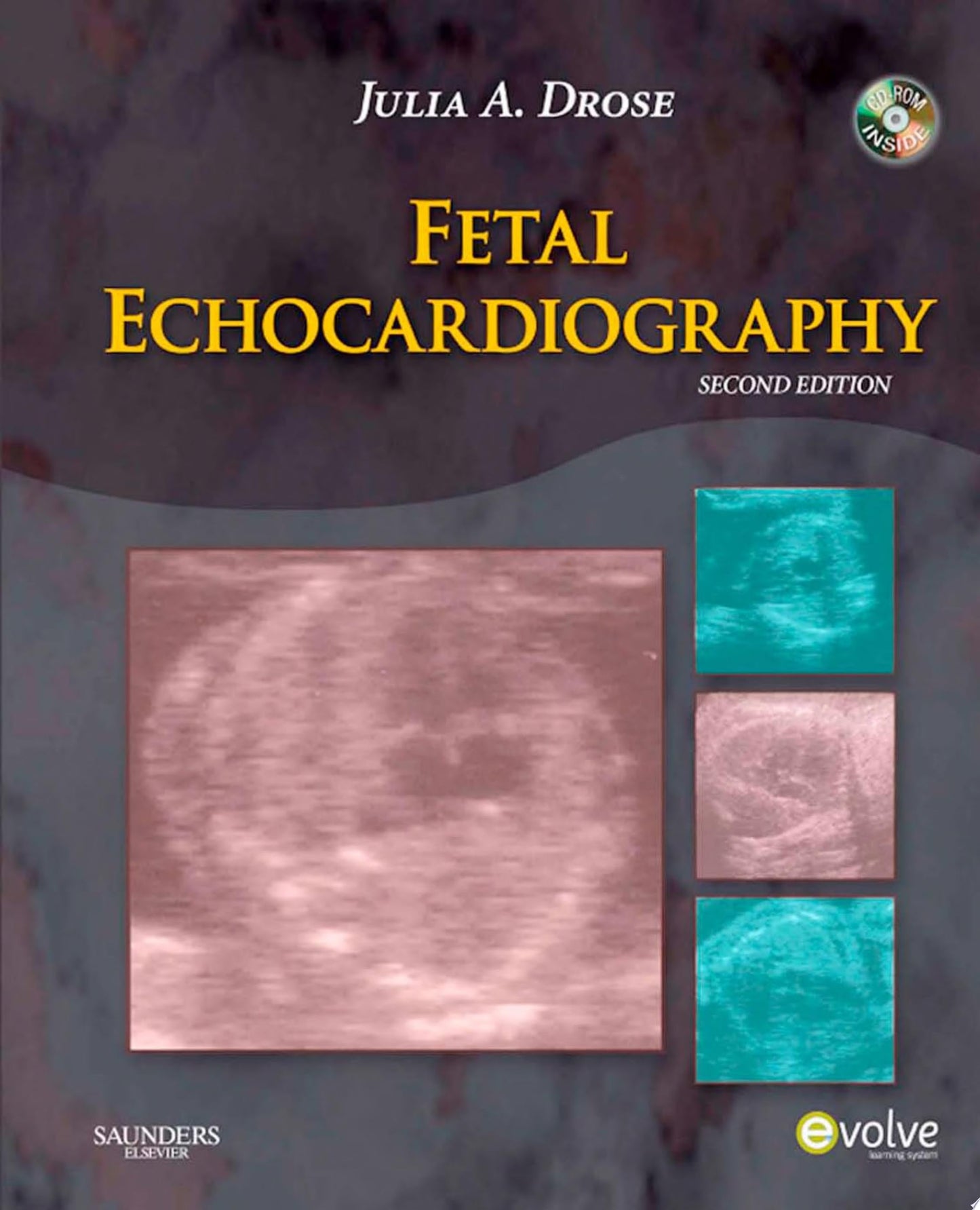 Fetal Echocardiography, 2nd Edition