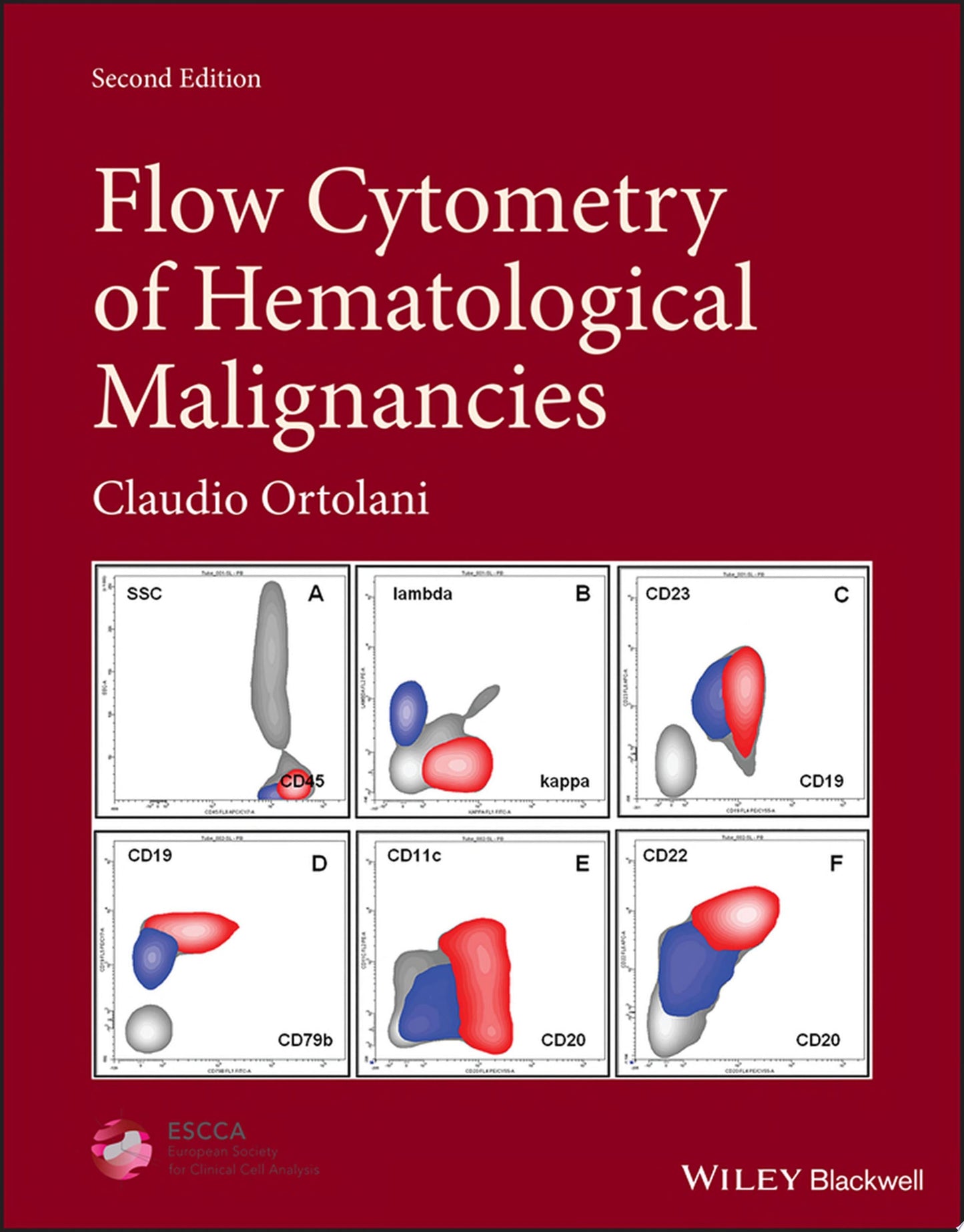 Flow Cytometry of Hematological Malignancies, 2nd edition