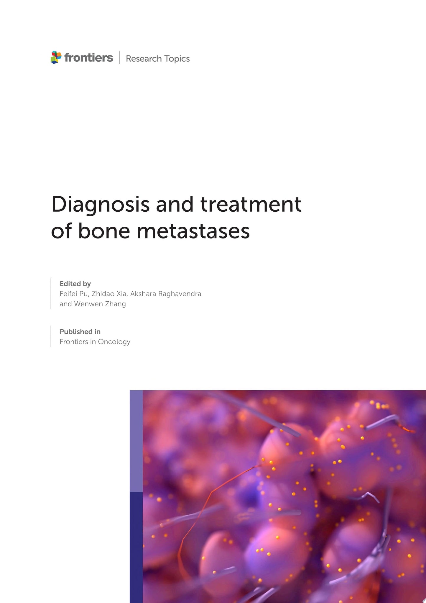 Diagnosis and Treatment of Bone Metastases